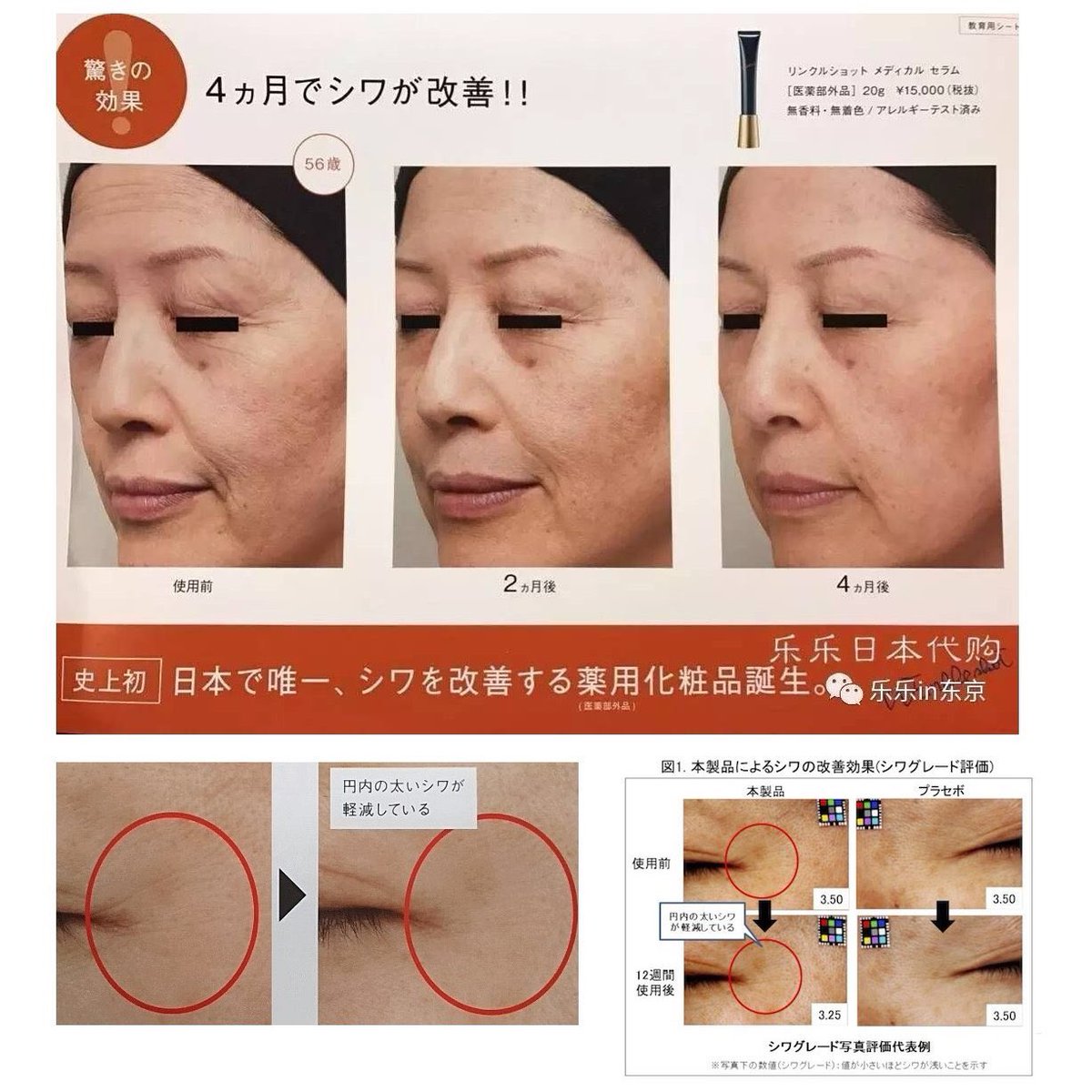 Pola Wrinkle Shot Serum before after